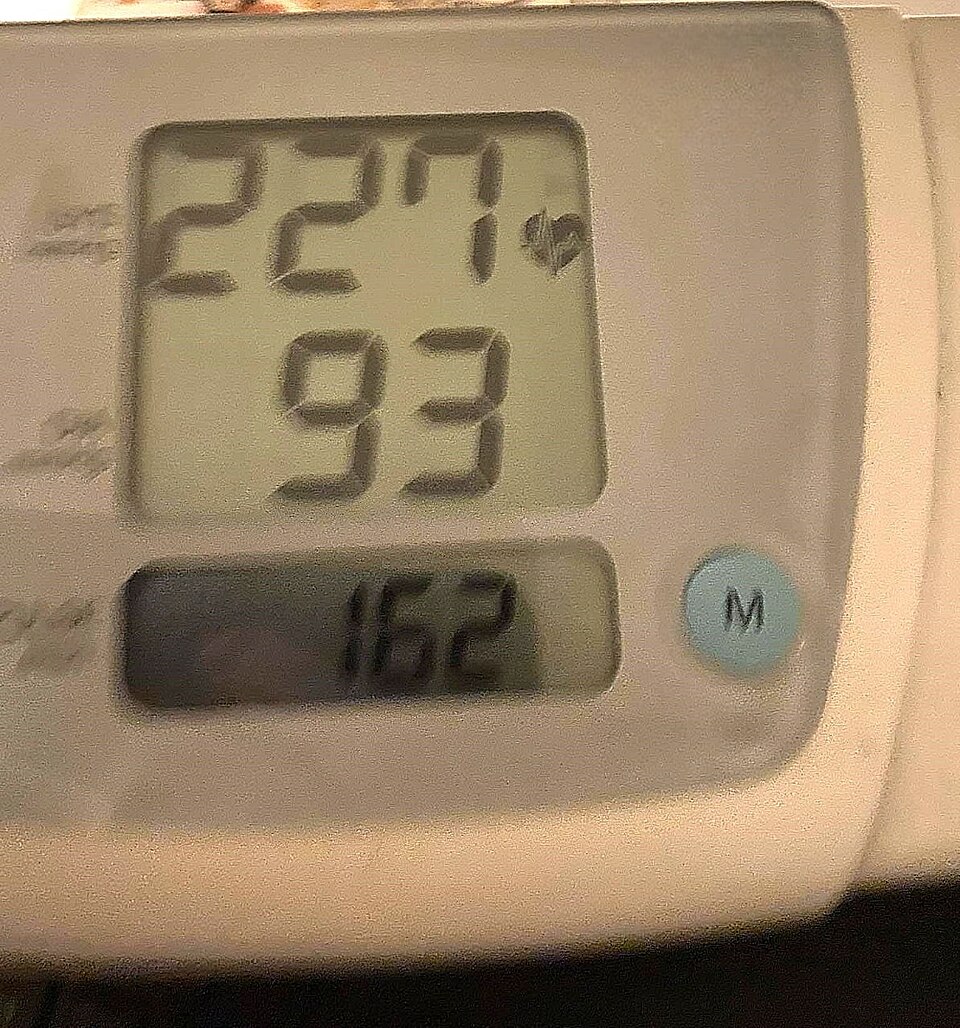 Приказ на екран на апарат за мерење крвен притисок кој покажува вредности од 227/93 mmHg и пулс од 162 отчукувања во минута.
